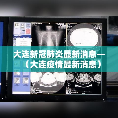 大连新冠肺炎最新消息—（大连疫情最新消息）