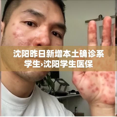 沈阳昨日新增本土确诊系学生›沈阳学生医保