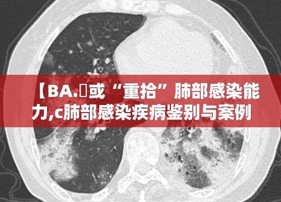 【BA.無或“重拾”肺部感染能力,c肺部感染疾病鉴别与案例剖析】