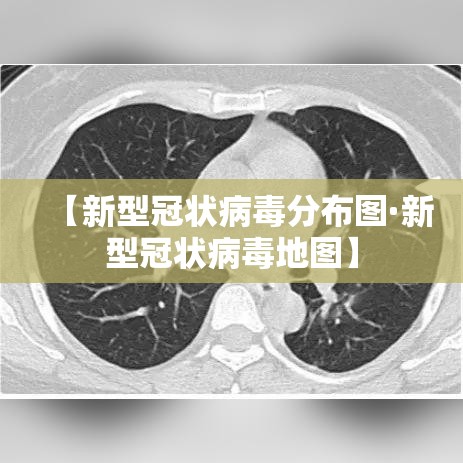 【新型冠状病毒分布图·新型冠状病毒地图】 【新型冠状病毒分布图·新型冠状病毒地图】