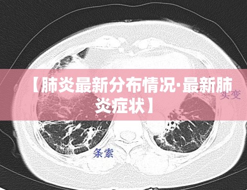 【肺炎最新分布情况·最新肺炎症状】 【肺炎最新分布情况·最新肺炎症状】